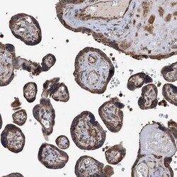 WHAMM Antibody, Novus Biologicals 25 &mu;L; Unlabeled:Antibodies, Polyclonal
